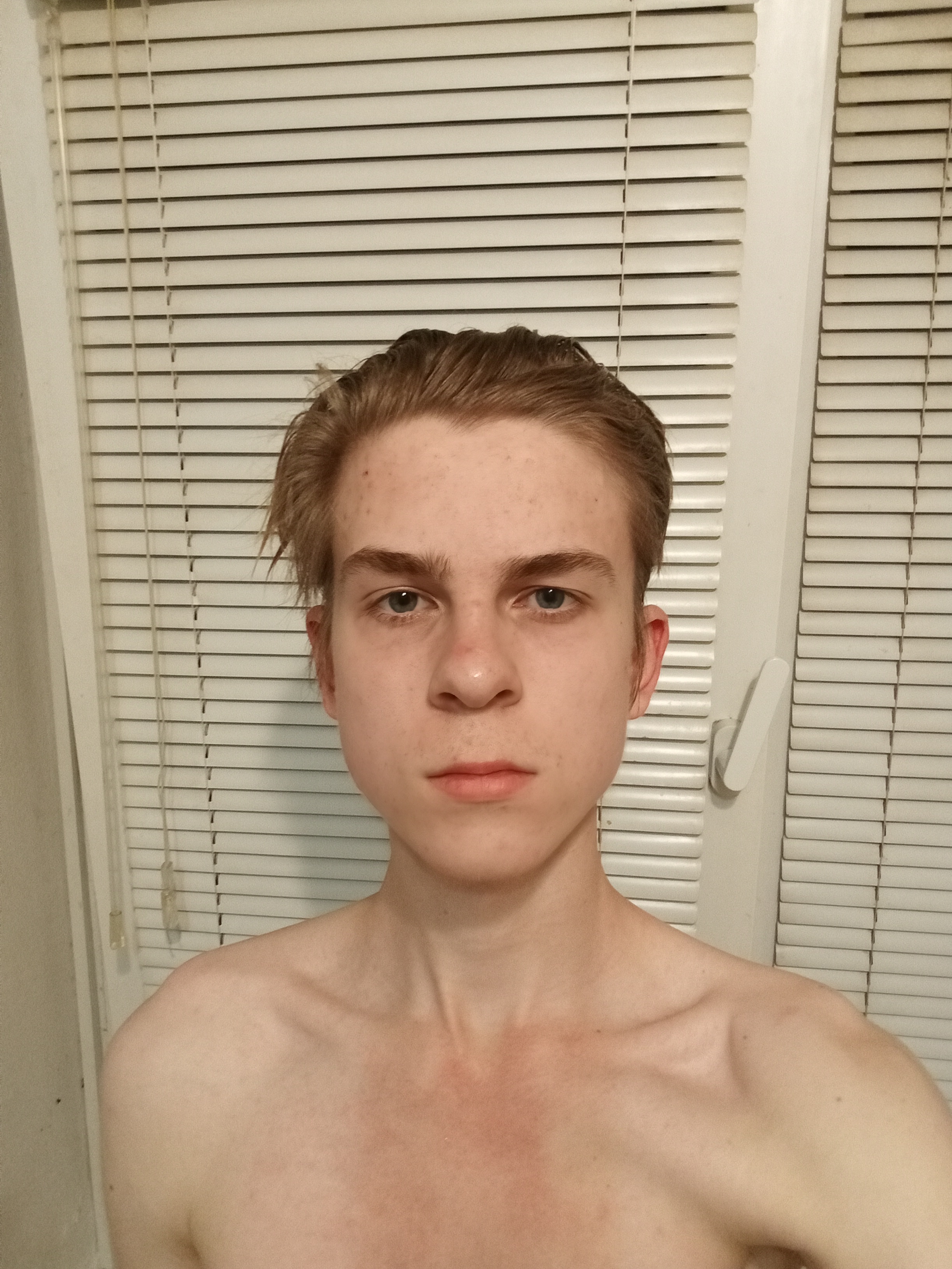 1000067644