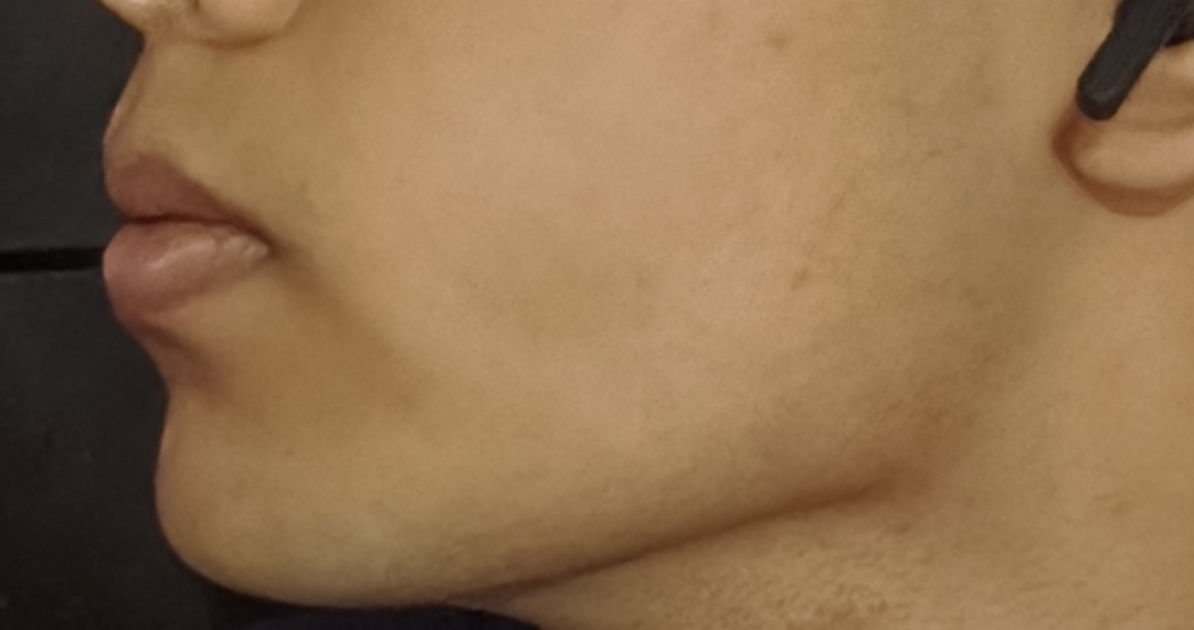 IMG 20260620 143645039 1