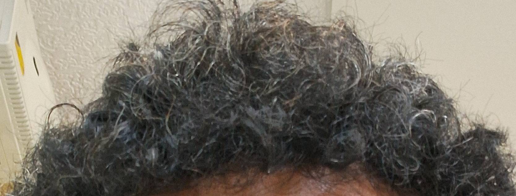 1000052775
