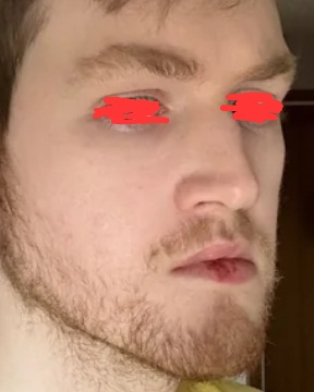 1000147106