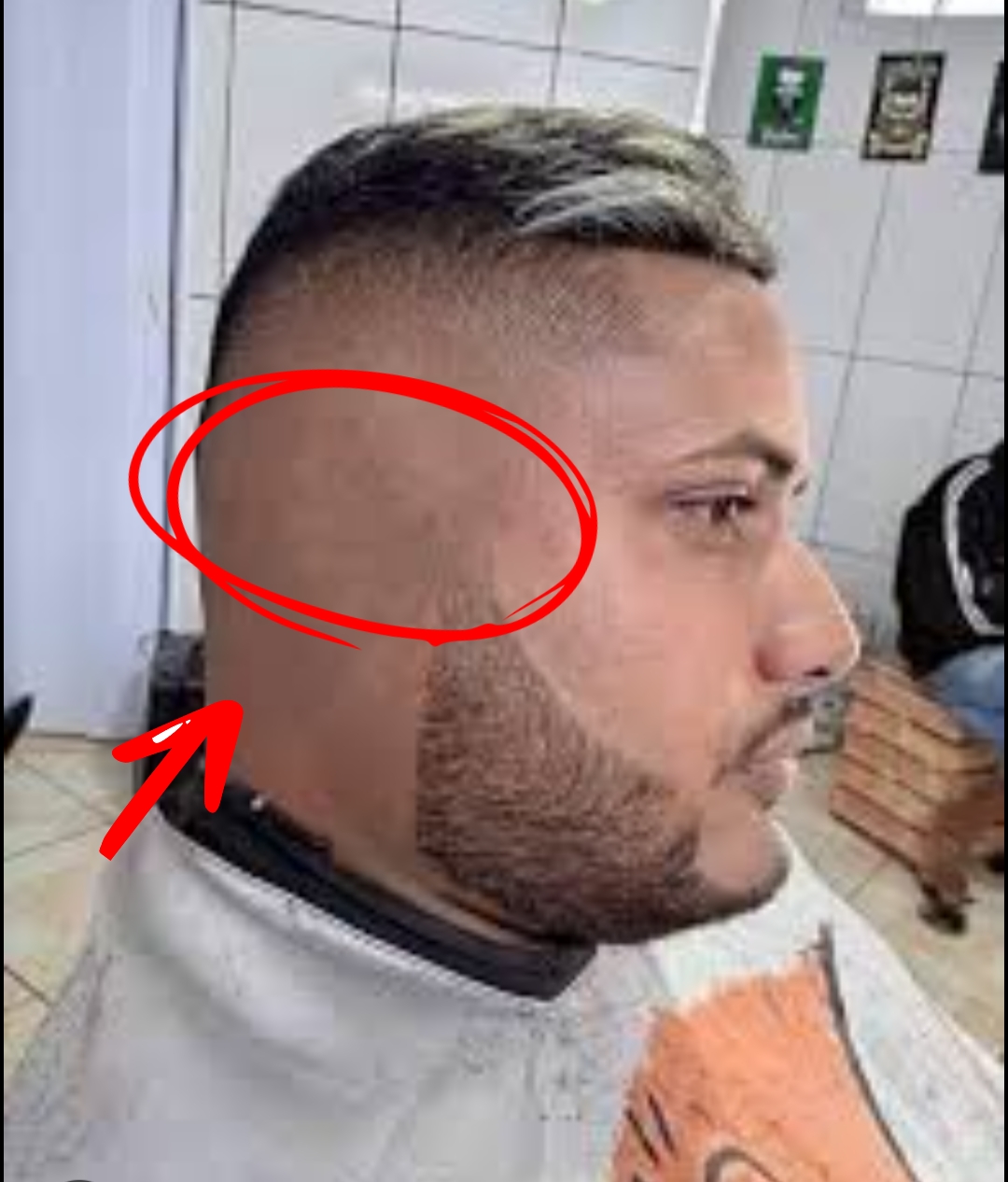 1000017797