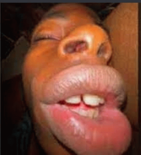 Big lips