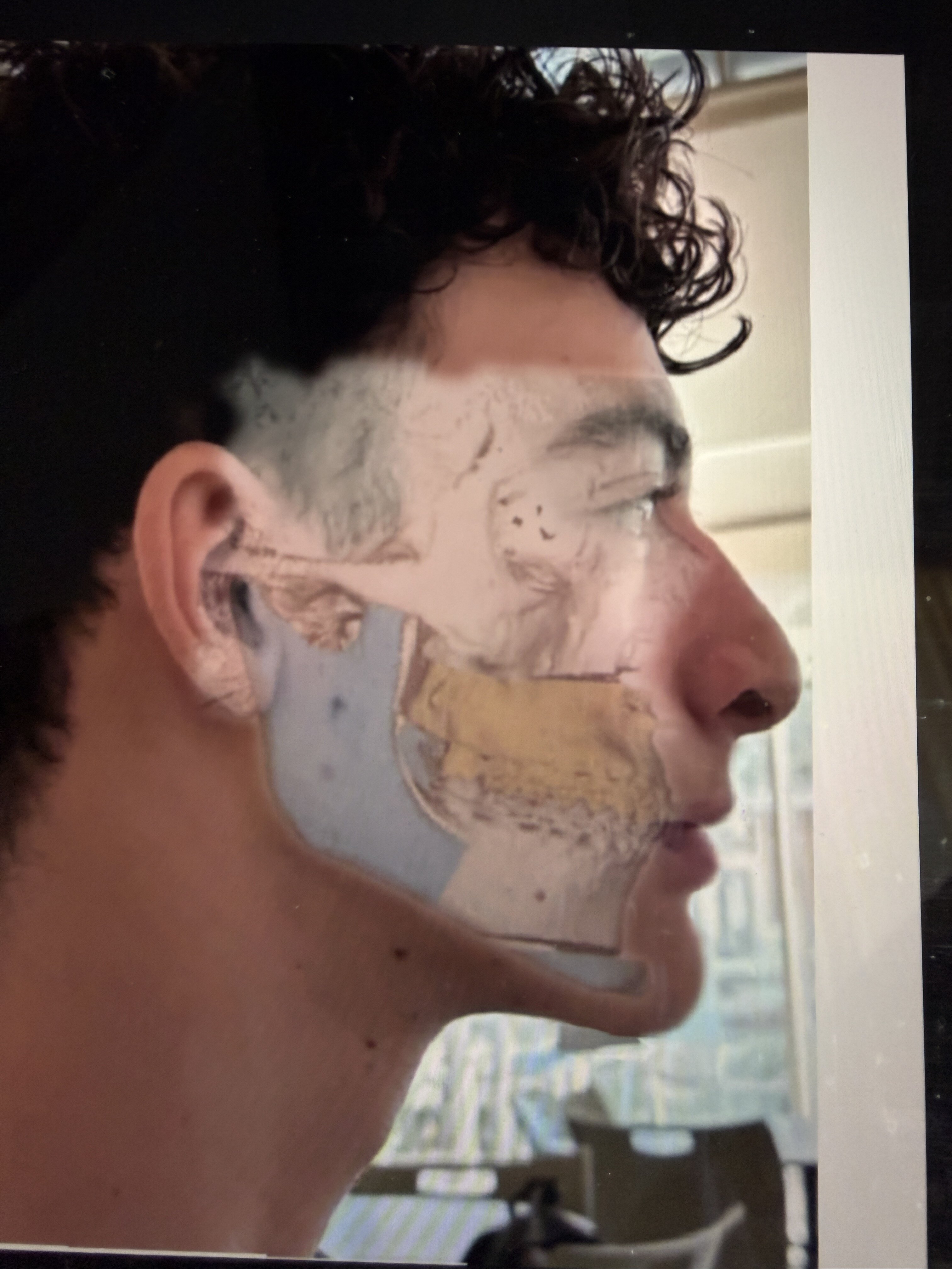 IMG 3510