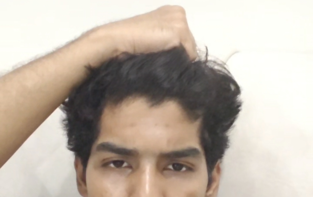 1000035553