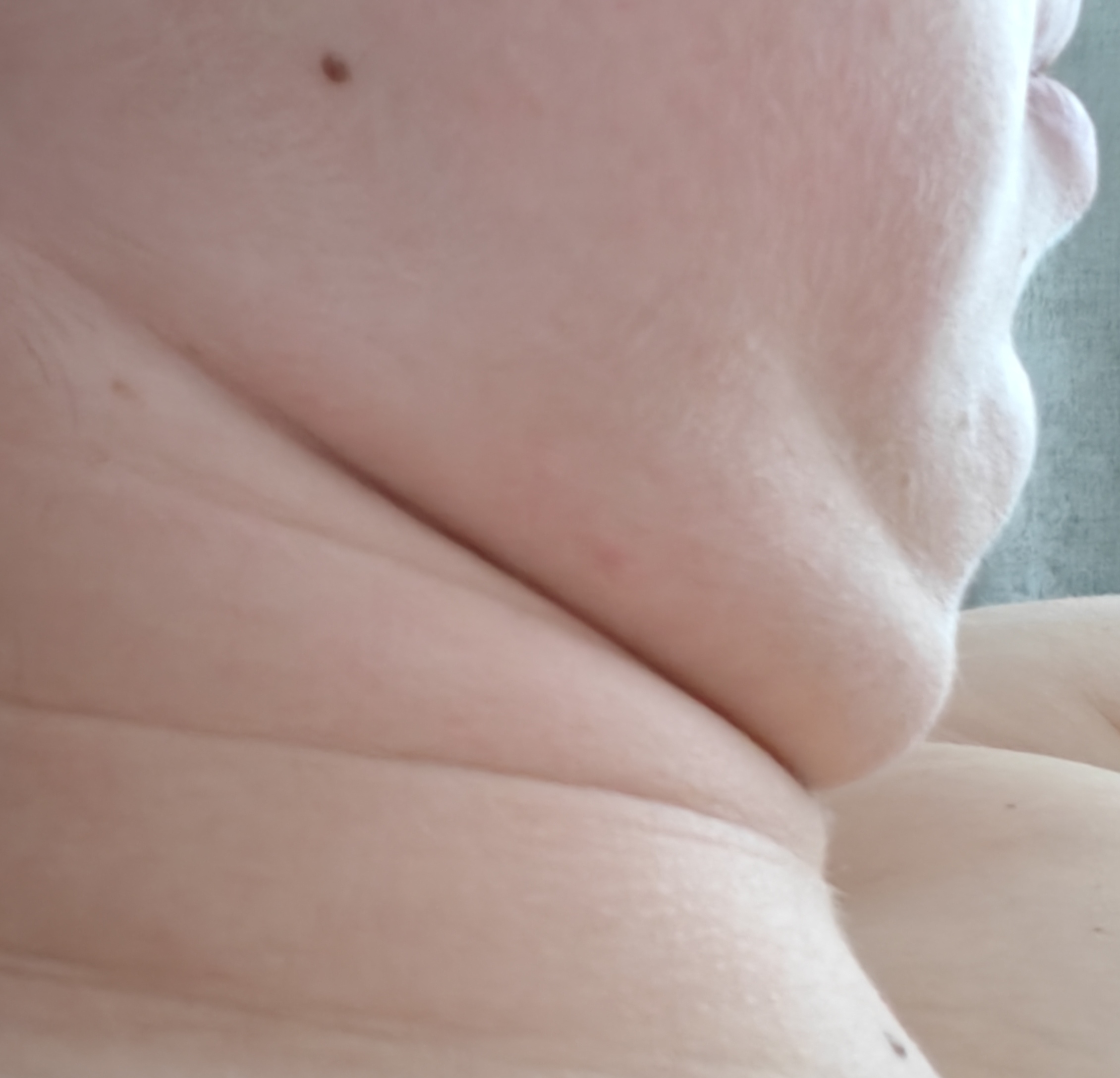 1000007476