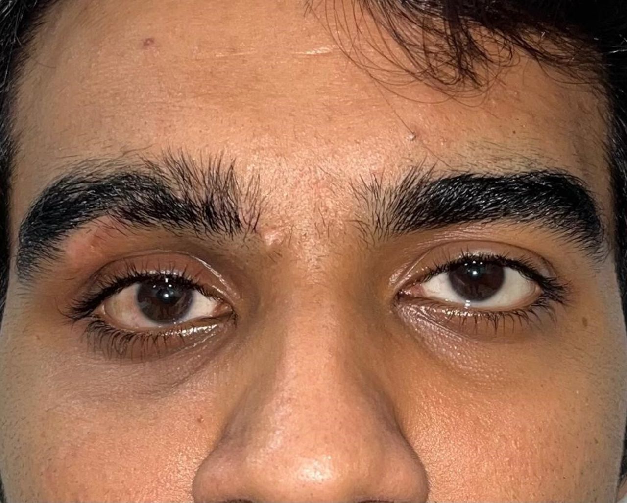 1000112516