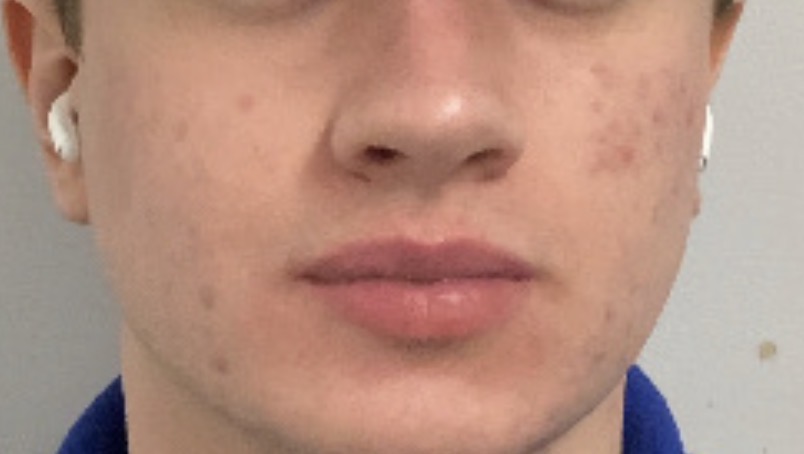 IMG 0893
