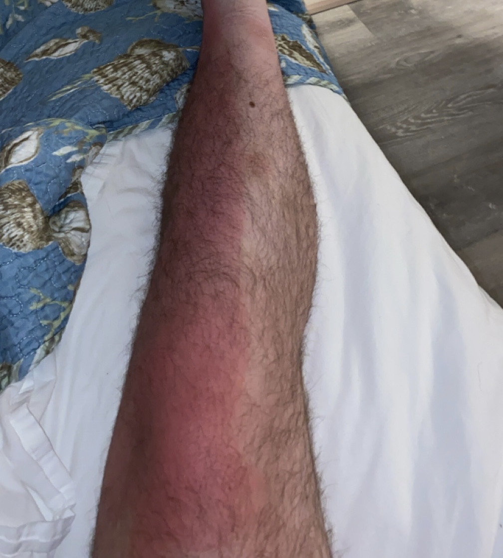 IMG 1391