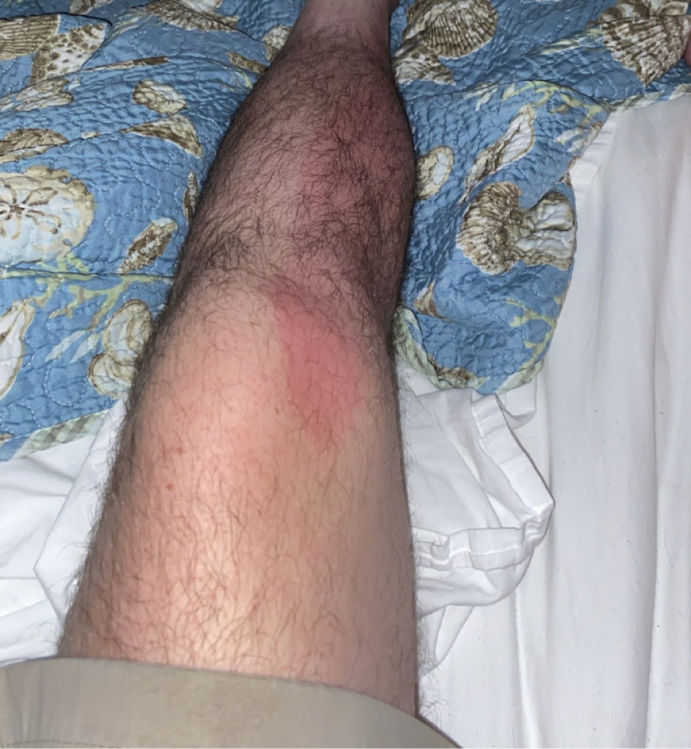 IMG 1392