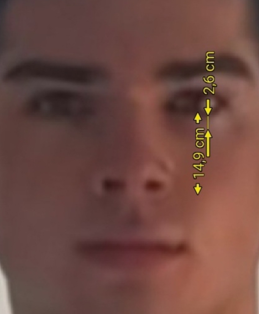 1000078799