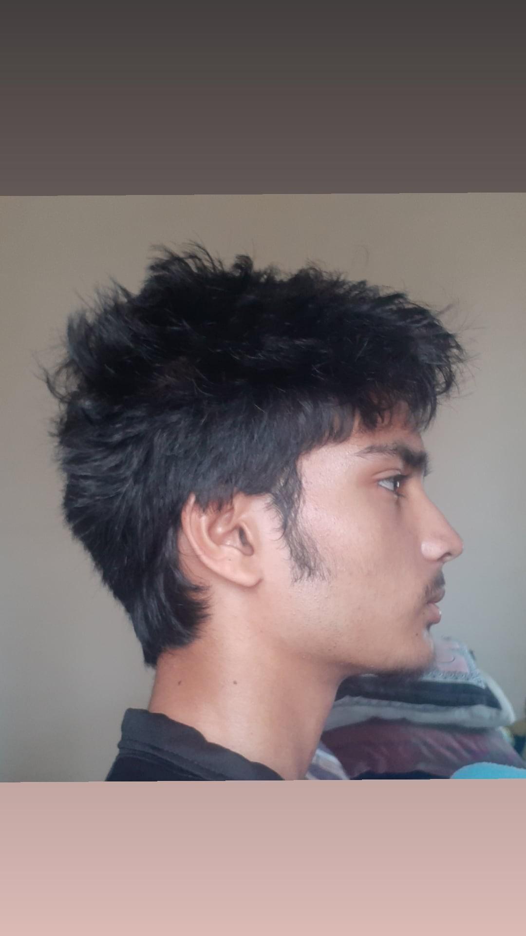 1000015618