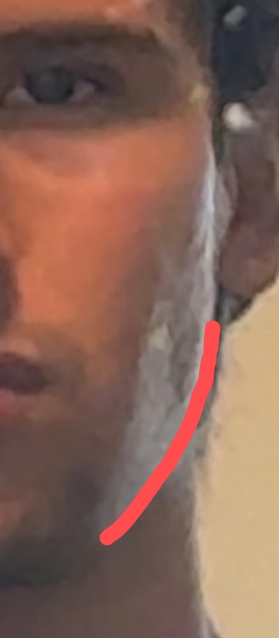 1000078847