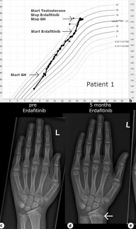 6489678 patient1
