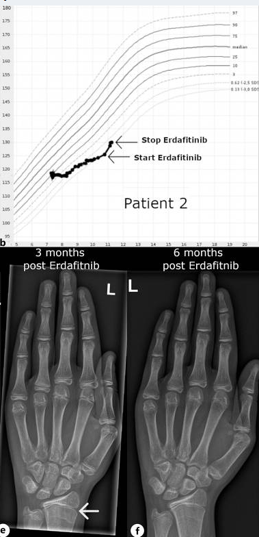 6489680 patient2