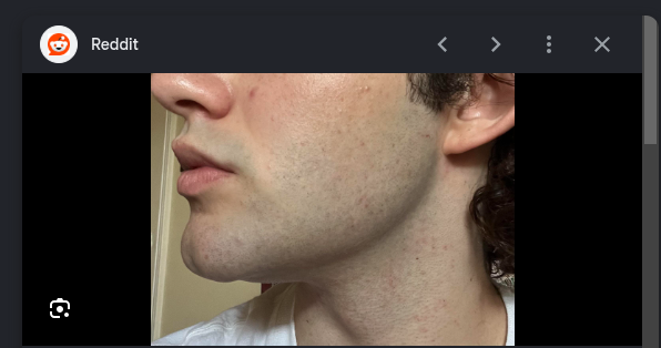 Any idea how to get rid of the dark areas where my beard grows  (specifically above my lip) : r/wicked_edge