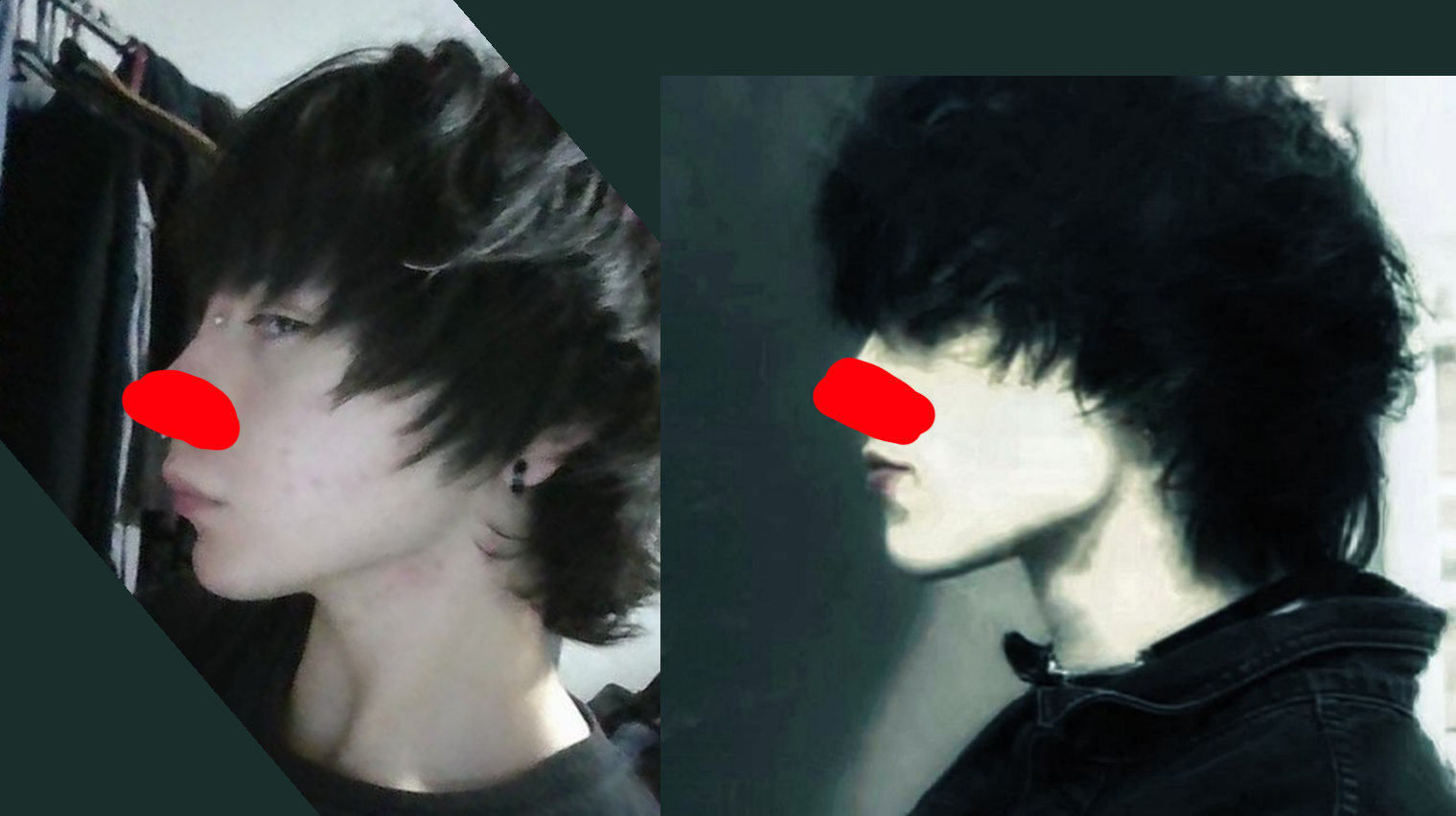 Chin projection