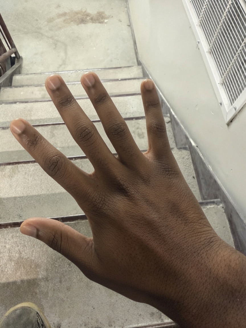 IMG 0232