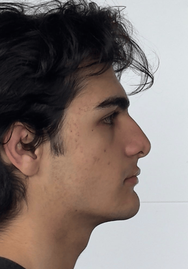 Giffront1