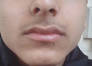 1782526113425