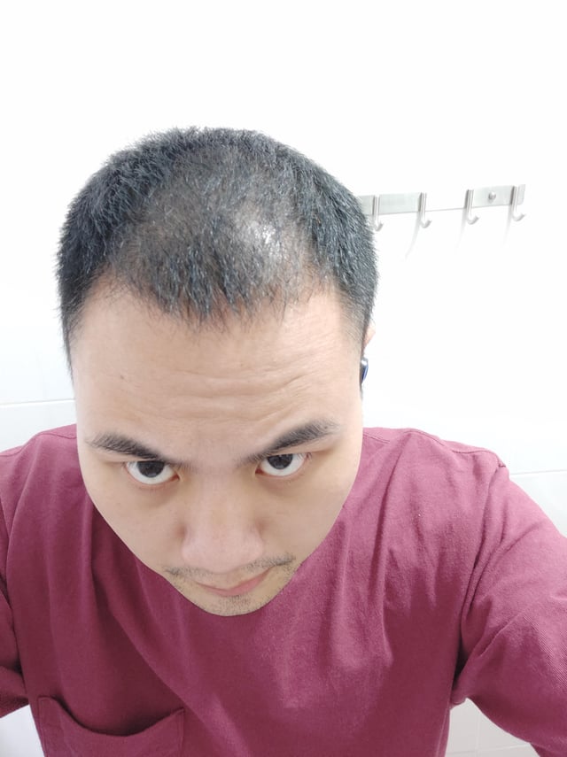 Chinese m29 hair suddenly started going so i decided to v0 w96at4884u761