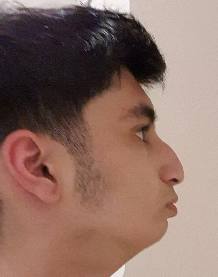 Murad side profil