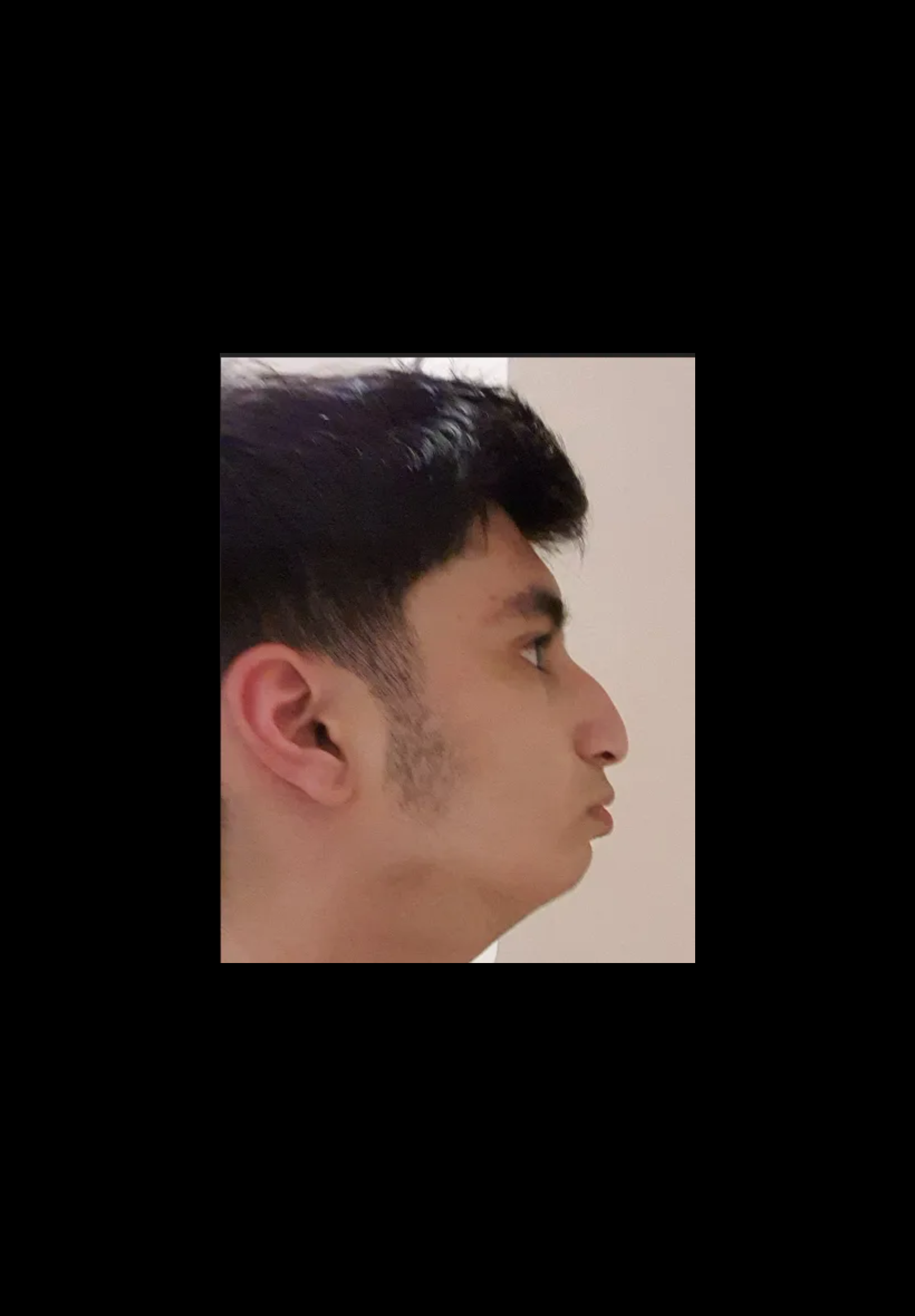 IMG 0291