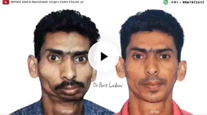 1000102146