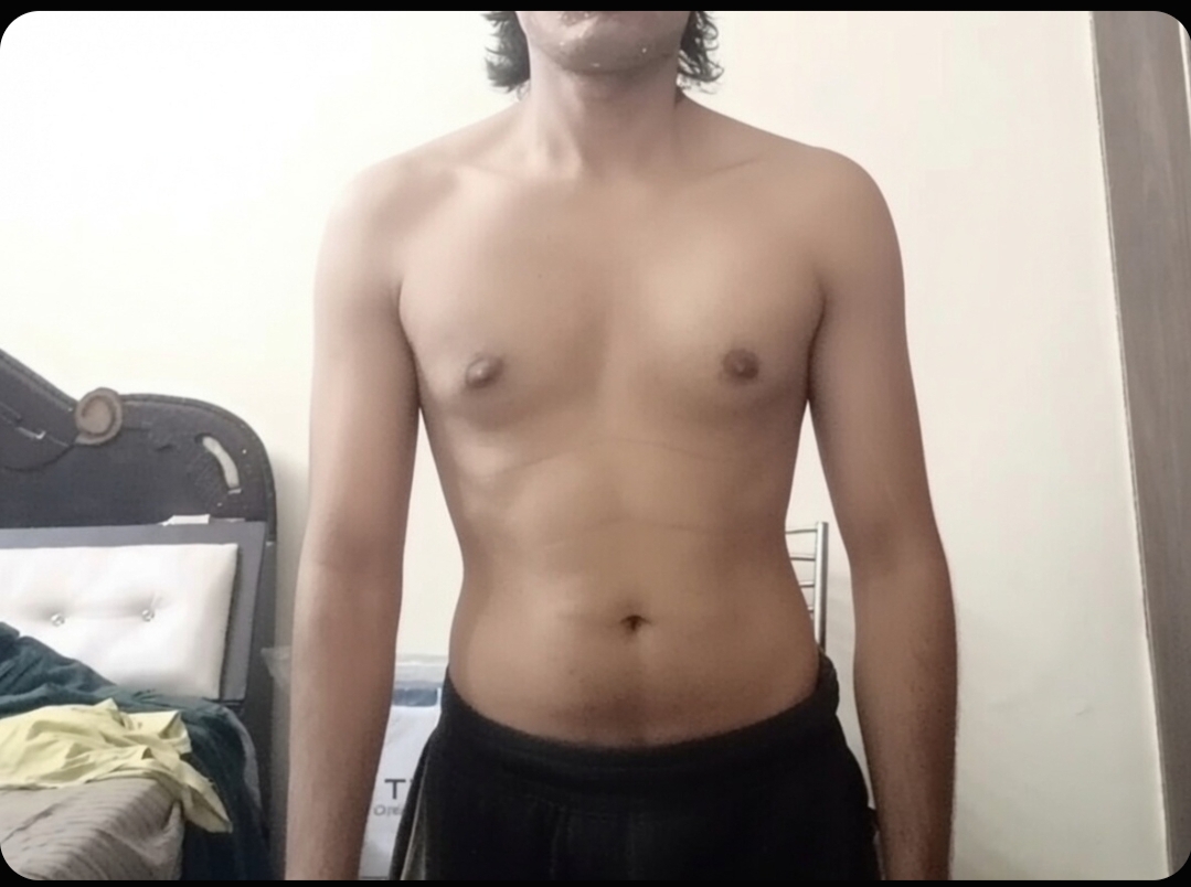 1000008981