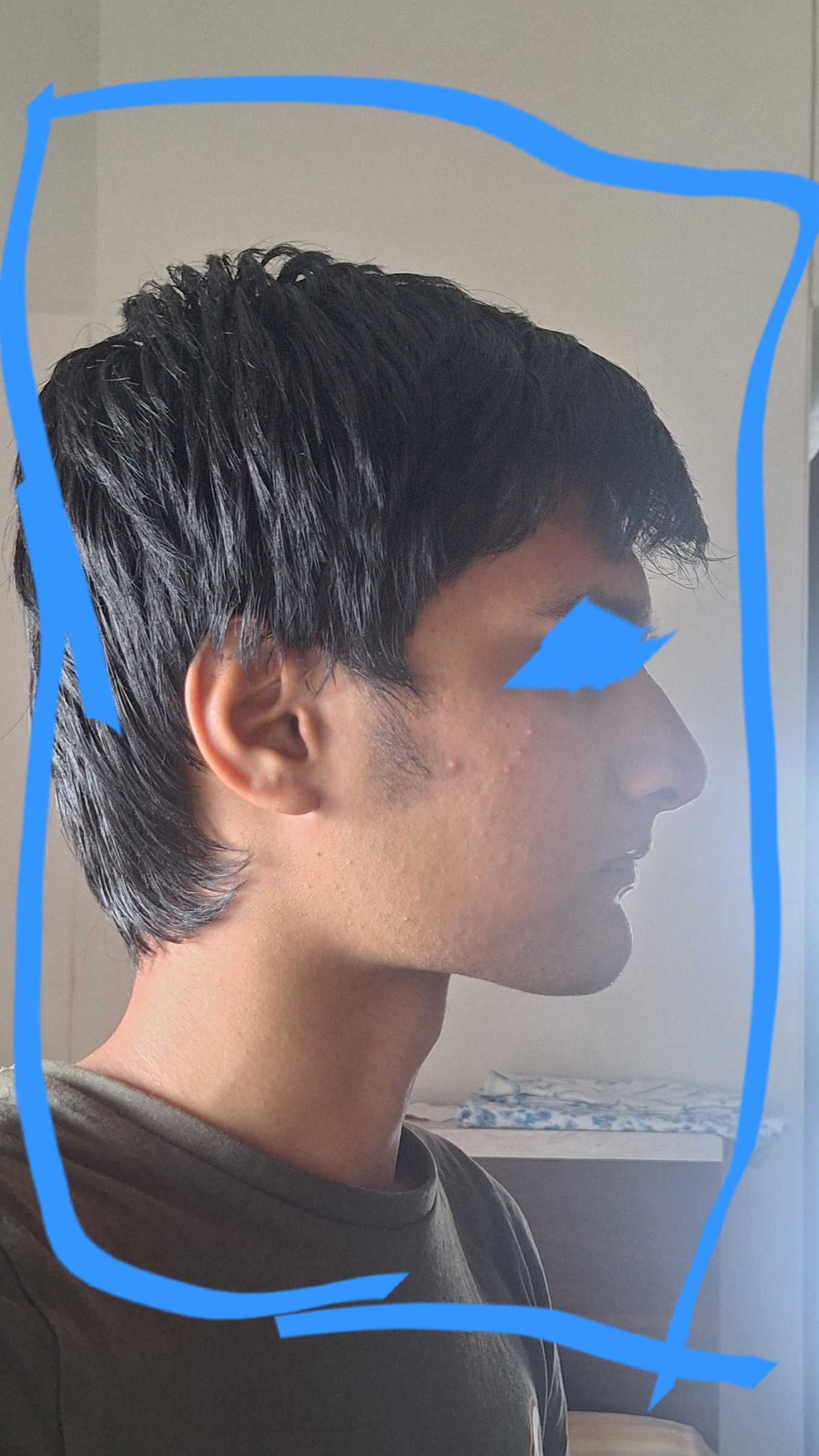 1000086723