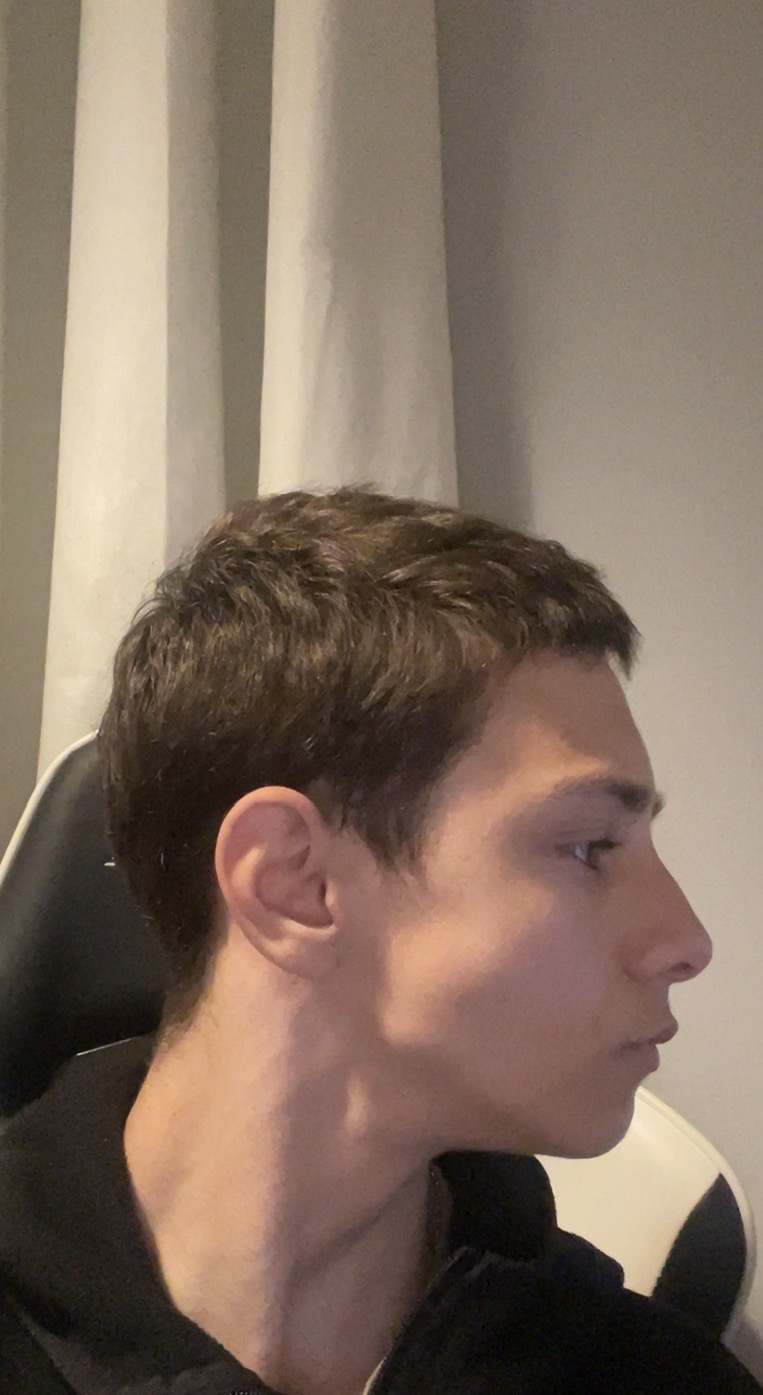 IMG 1187