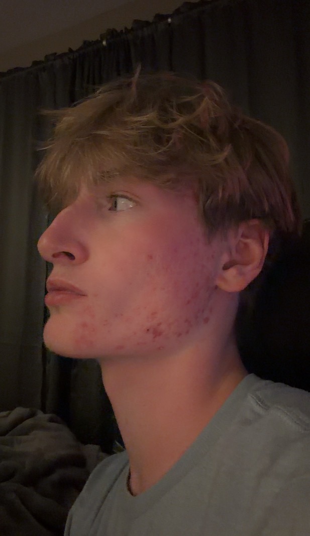 IMG 1777