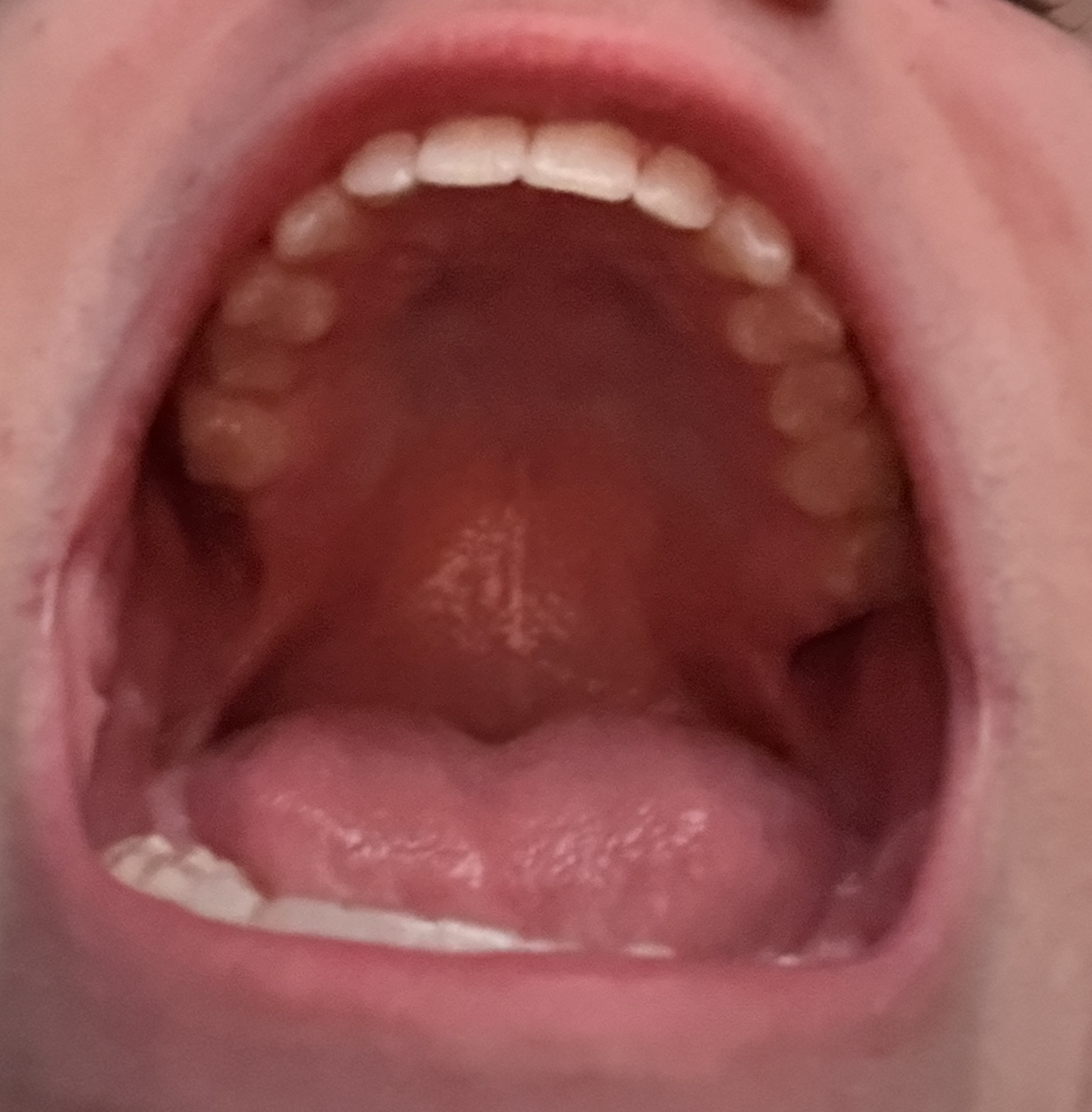 IMG 7492