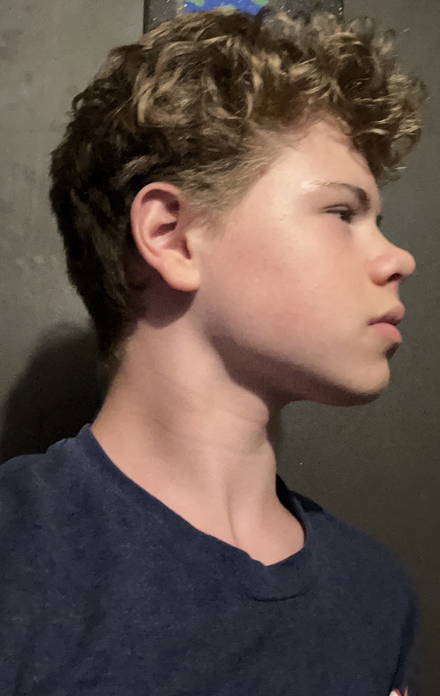 IMG 0941