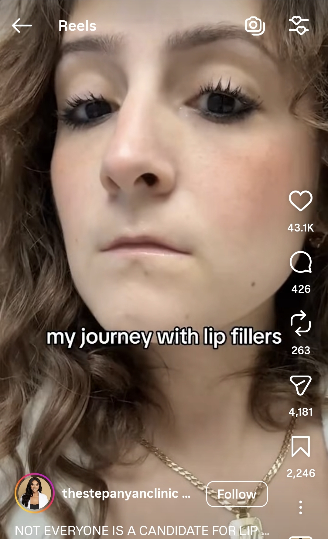 1000097472