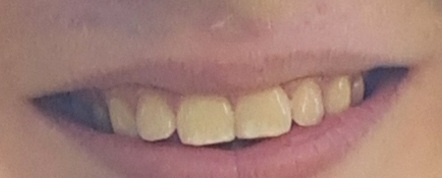 1000067412