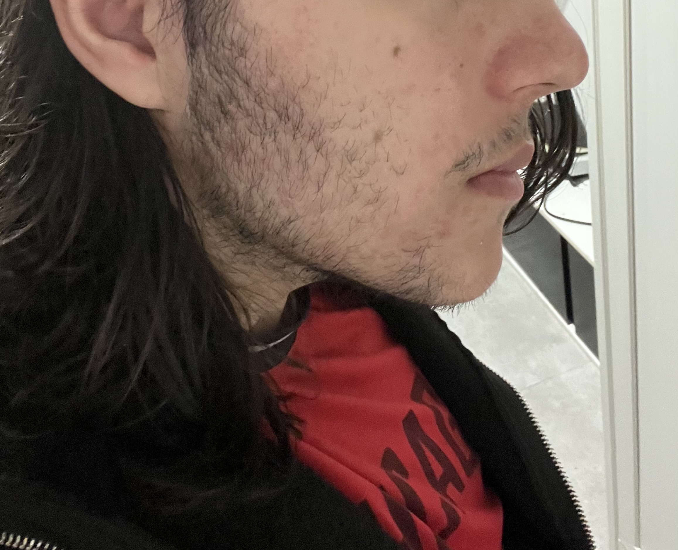 IMG 2614