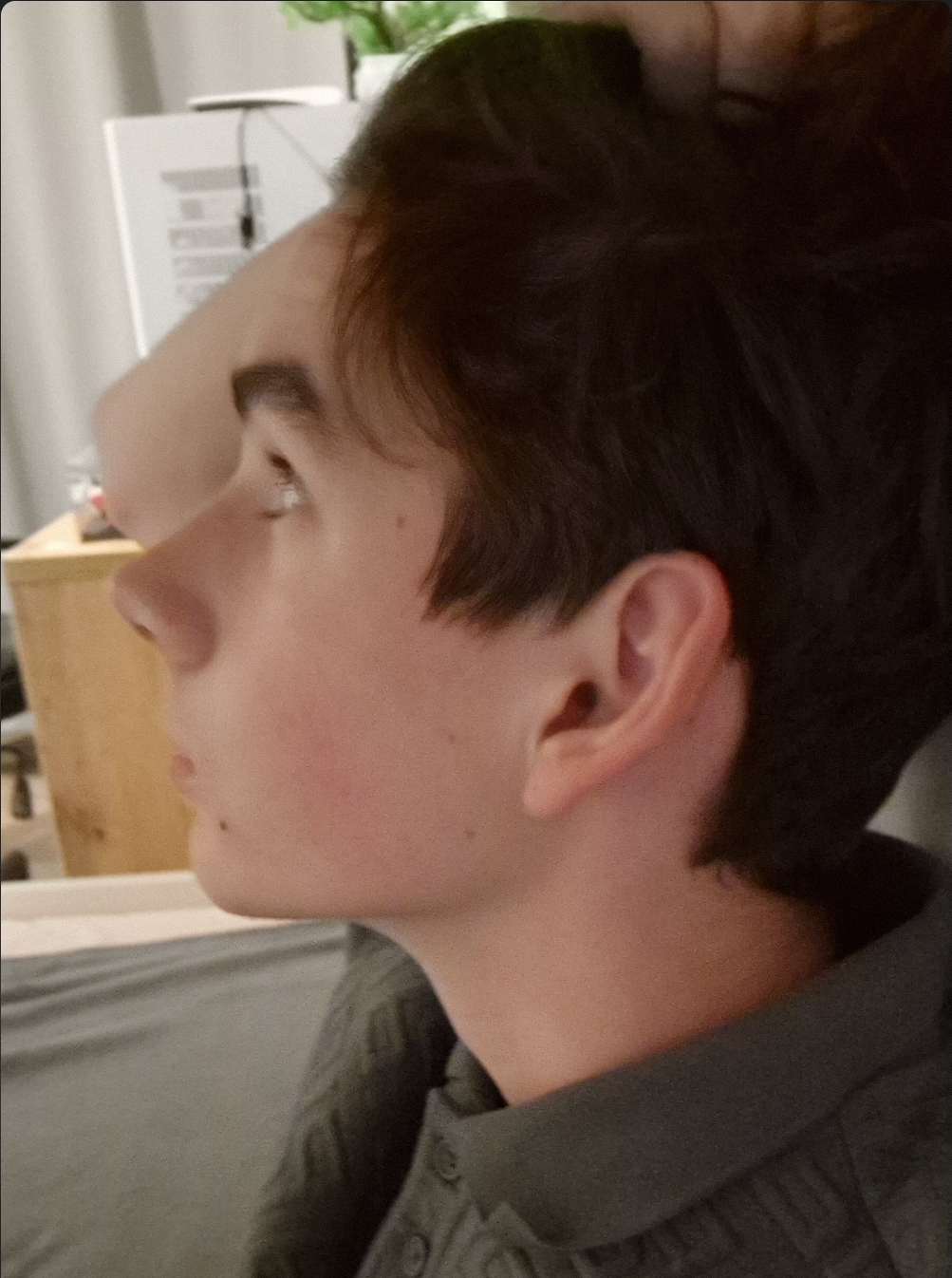 1000043177