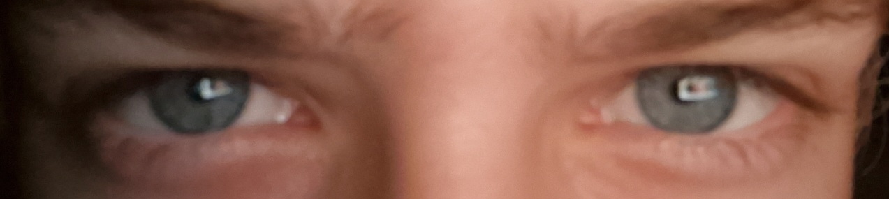 1000058932