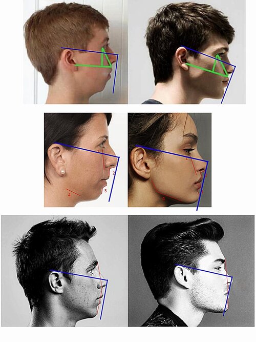 a-good-way-to-measure-forward-facial-growth-the-blue-lines-v0-5mk2jlu588v21.jpg