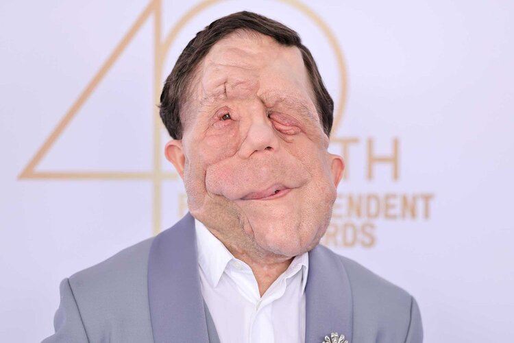 Adam-Pearson-2025-Film-Independent-Spirit-Awards-050125-1cc0863a598e4d0884a00e740a767dac.jpg