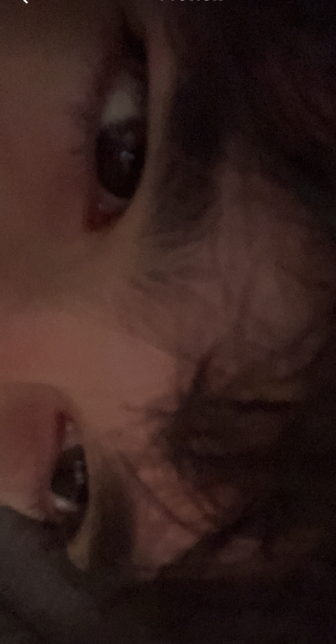 Eyearea