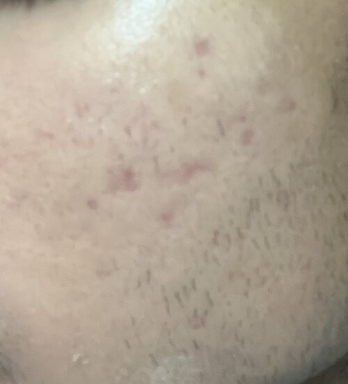 IMG 2564