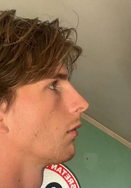 Nose too straight.png