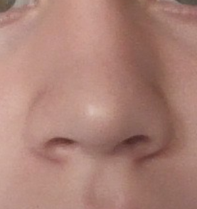 Bethamethasone 2wks 