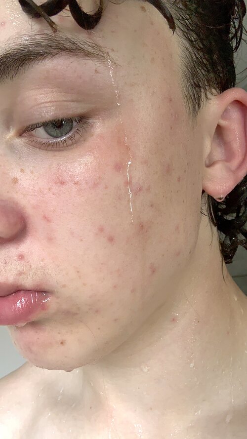IMG 9260