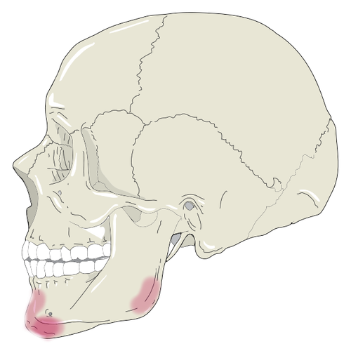 Skull2