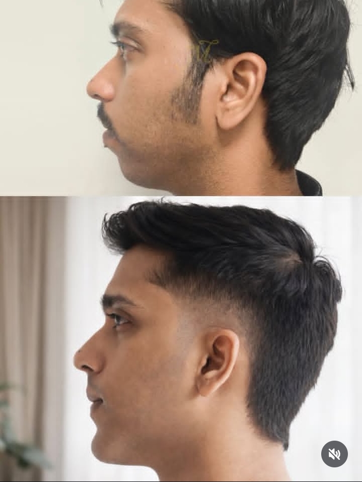 1000102628