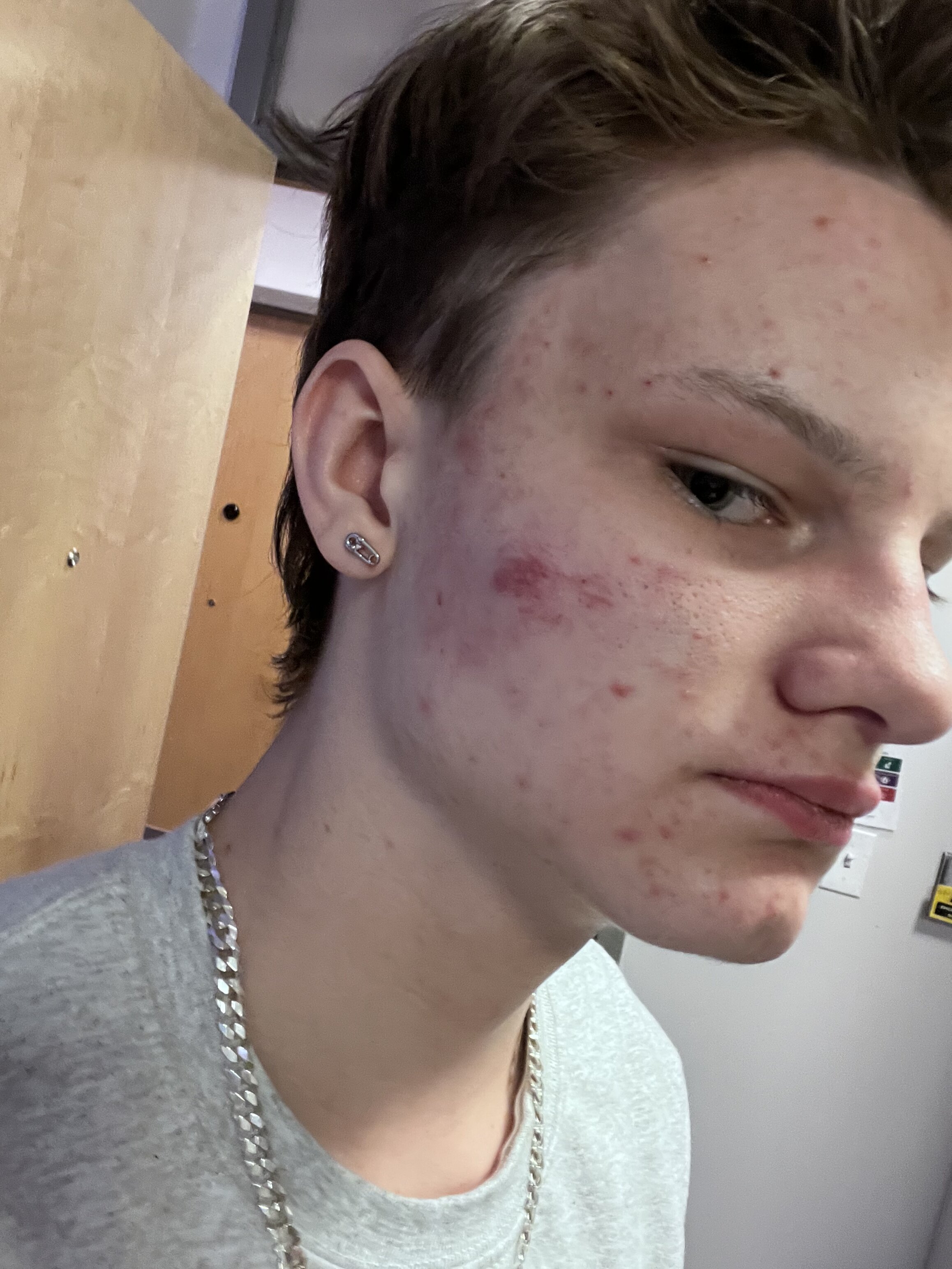 IMG 2875