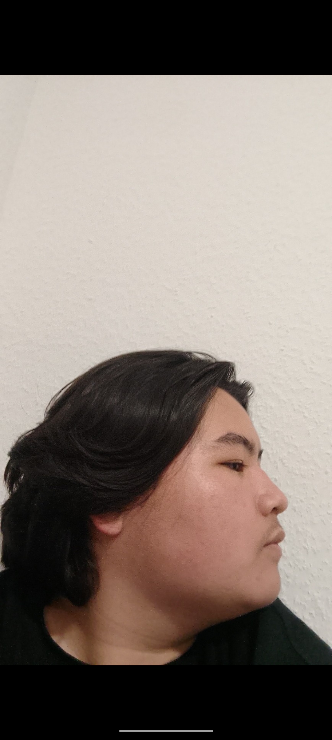 1000036704