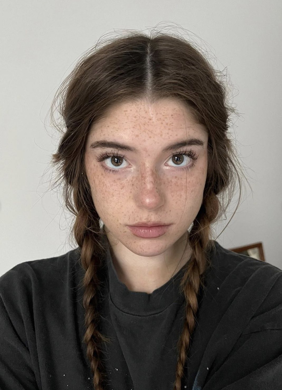 WhiteFreckles